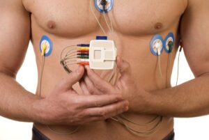 Holter Cardiaco ECG Dinamico 24 H a cassino presso la figebo