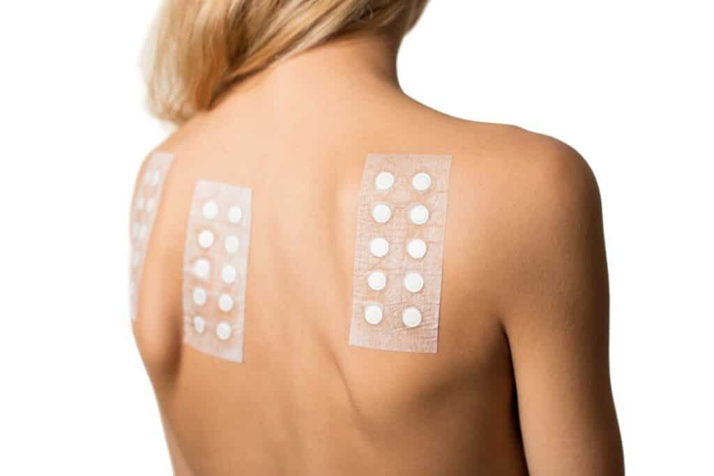 Patch Test a cassino presso la figebo per le allergie