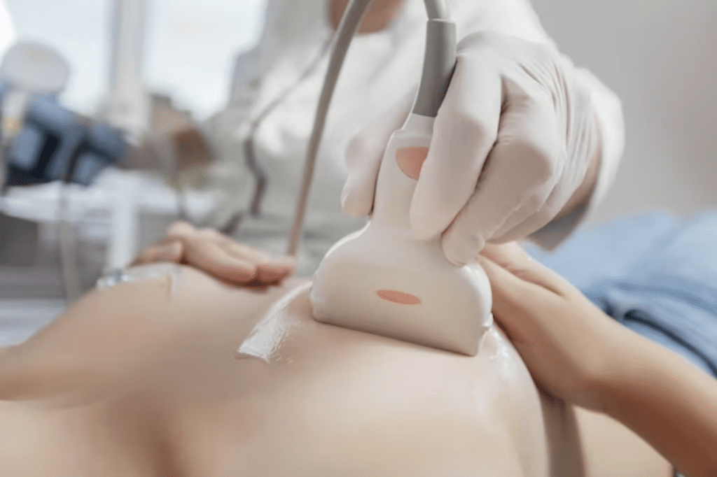 Agoaspirato Mammario a cassino presso la figebo