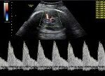 Ecografia con Flussimetria Ostetrica