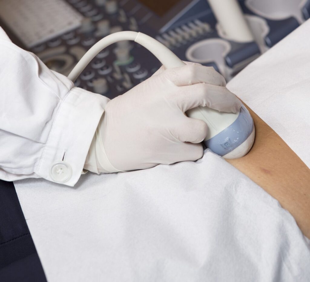 Monitoraggio ecografico ovulazione a cassino presso la figebo