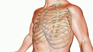 tac torace presso figebo a cassino