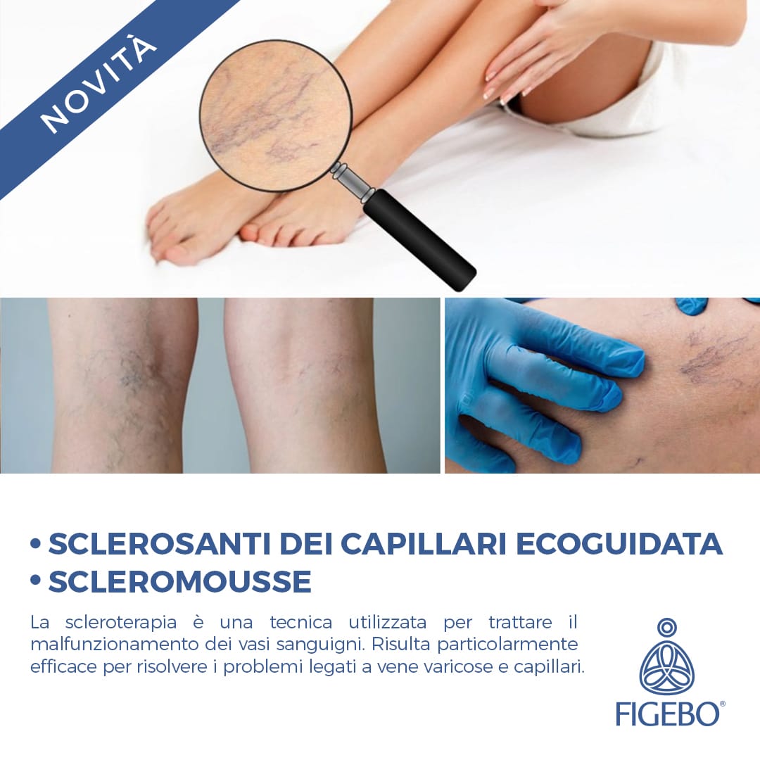 Sclerosanti Ecoguidata Dei Capillari